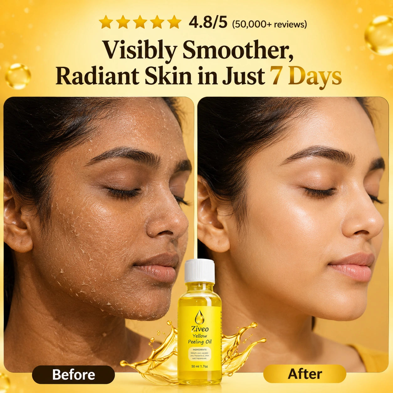 Ziveo® - Magic Peeling Oil (Buy 1 Get 1 Free)